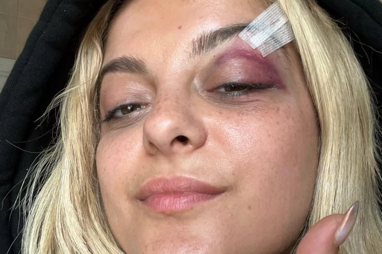 Bebe Rexha hit in face during concert